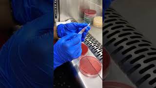 BB+ culture #laboratory #pharmacy #kenofbiology  #ashnasidd #science #microbiology #experiment