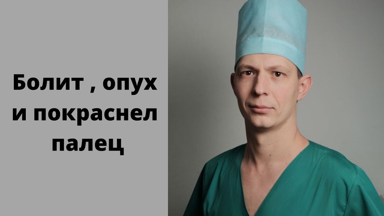 Панариций. Дергает и болит палец. Опух и покраснел. Что делать, куда обращаться