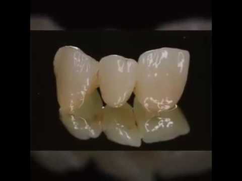 Ceramill Zolid FX Multilayer italiano