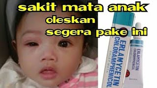 Download lagu Erlamycetin chloramphenicol obat buat sakit mata balita dan anak2 obat paling ampuh dan aman mp3 Download lagu Erlamycetin chloramphenicol obat buat sakit mata balita dan anak2 obat paling ampuh dan aman mp3