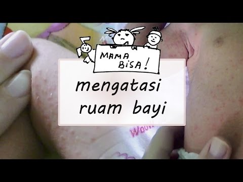 Oak potensi kulit rebusan Anggota peningkatan mantra