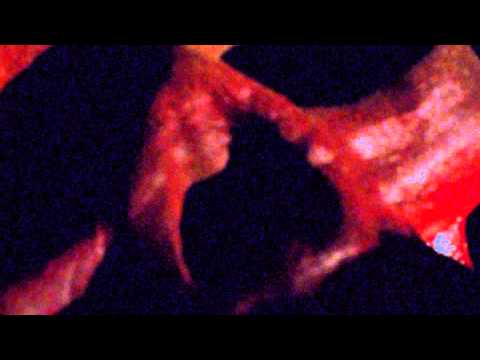 Beneath the Crawlspace