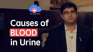Causes of blood in urine