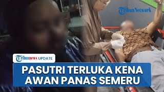 Kondisi Pasutri usai Kena Awan Panas Semeru saat Melintasi Jembatan Gladak, Alami Luka Bakar