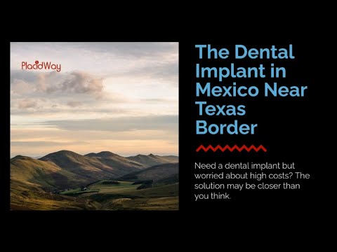 Best Dental Implants in Mexico near Texas Border