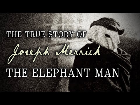 "The True Story of Joseph Merrick: 'The Elephant Man'" (1997)