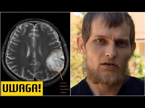Szybko zbudować brzana mięśni Rozwój tylnych deltoids