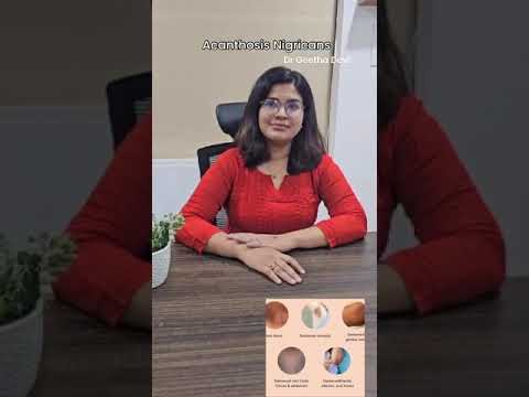 What is Acanthosis Nigricans | Explained by Dr Geetha Devi - Best Dermatologist in Hyderbad