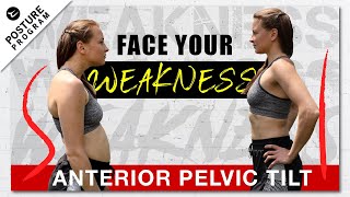 Best Workout to FIX ANTERIOR PELVIC TILT & Rounded Shoulders (AMAZING RESULTS)
