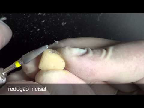 download lagu mp3 mp4 Acrilico Alike, download lagu Acrilico Alike gratis, unduh video klip Acrilico Alike