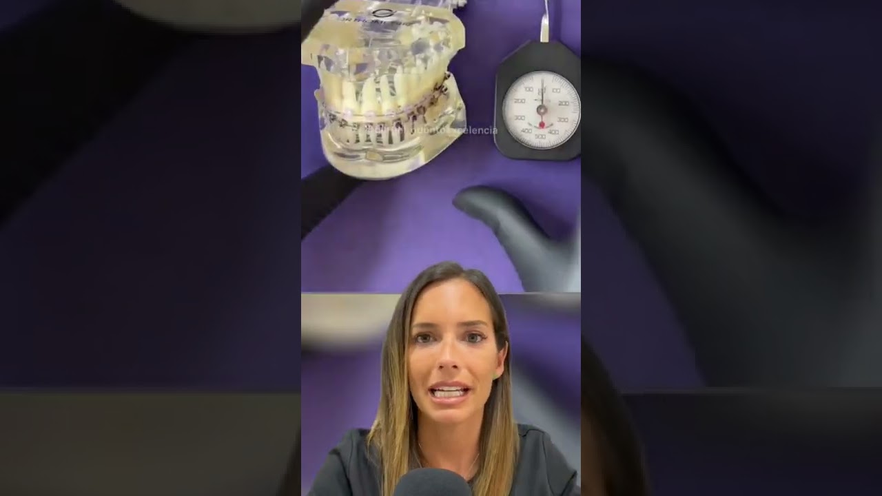 SI usas ELÁSTICOS INTERMAXILARES debes saber ESTO para EVITAR UN ERROR MUY GRAVE con tus BRACKETS