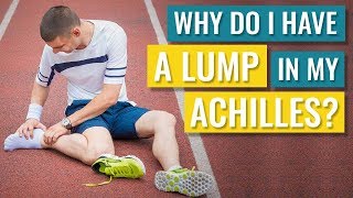Why do I Have a Lump in my Achilles Tendon?
