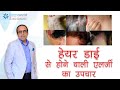 हेयर डाई से होने वाली एलर्जी का उपचार Dr