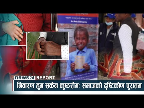 निवारण हुन सकेन कुष्ठरोगः समाजको दृष्टिकोण पुरातन - NEWS24 TV