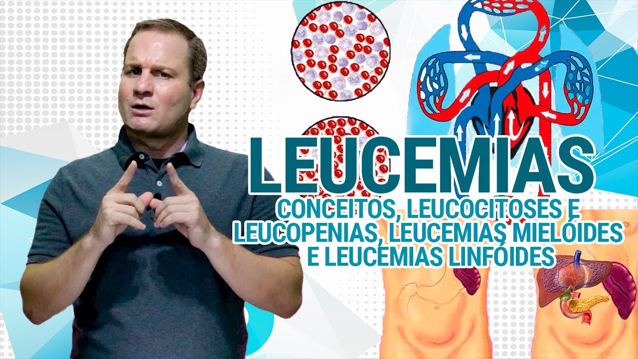 Leucemias: Aula completa