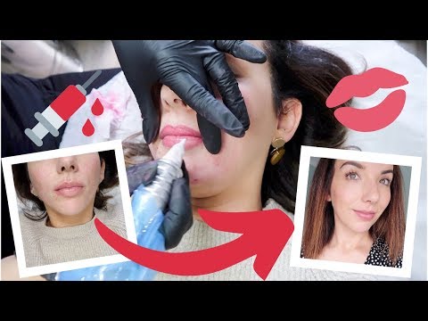 GETTING MY LIP BLUSH TATTOO - FULL PROCESS & HEALED!