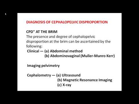 A CLASS ON CEPHALOPELVIC DISPROPORTION (CPD) BY  Dr Sri Lakshmi Asst professor,OBGY.