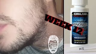 Minoxidil Beard | Week 12 | The Experiment |  #FacialFuzzFridays