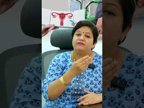 Copper T Effect & Side Effects Explained! Dr. Abinaya Copper T Effect & Side Effects Explained!