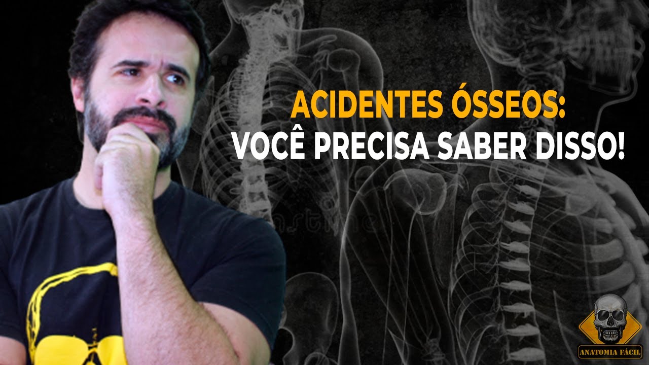 ACIDENTES ÓSSEOS: TUDO QUE VOCÊ PRECISA SABER!