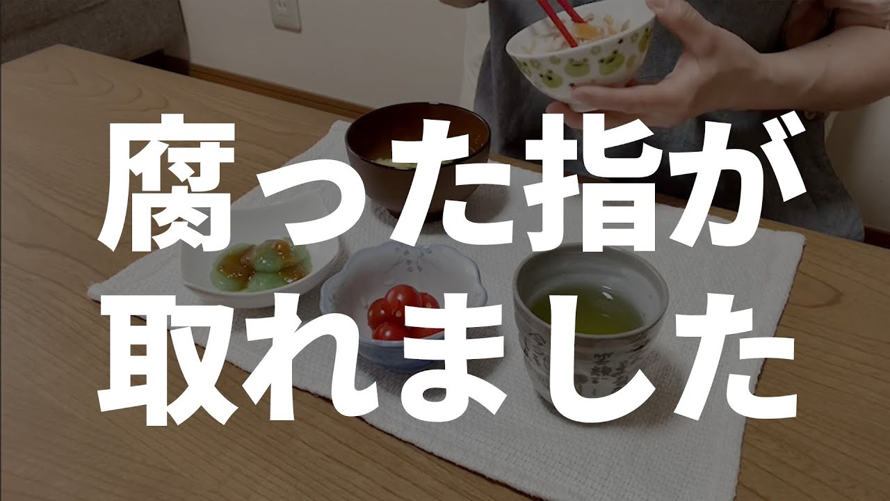 【60代一人暮らし】母の足の指に、奇跡が起こりました