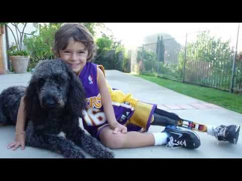 少了一隻腳、少了一隻手，卻激勵人心的男孩 (The Inspirational Story Of 9-Year-Old Ezra Frech)