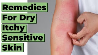 10 Home Remedies & Treatments for Eczema and Dry, Itchy and Sensitive Skin