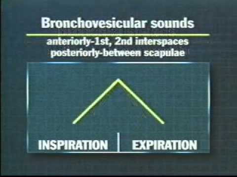 Normal Breath sounds
