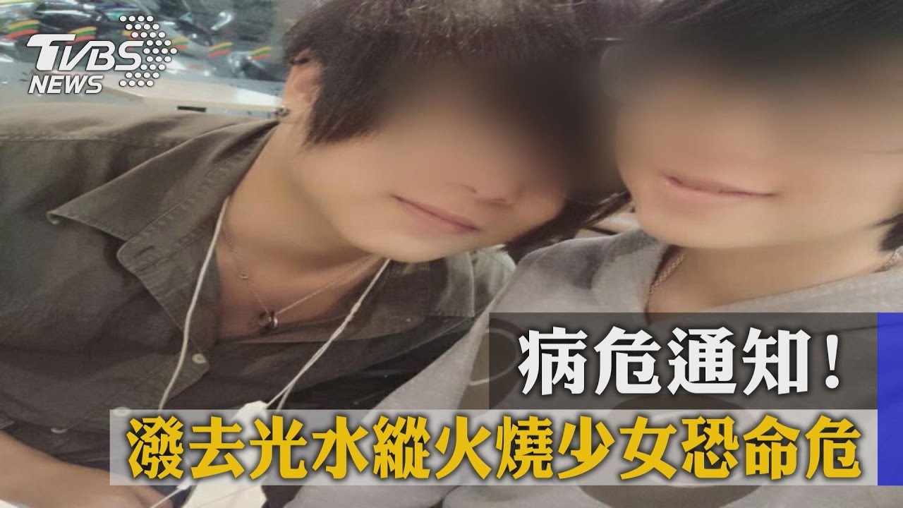 病危通知!不滿分手潑去光水 火燒少女命危