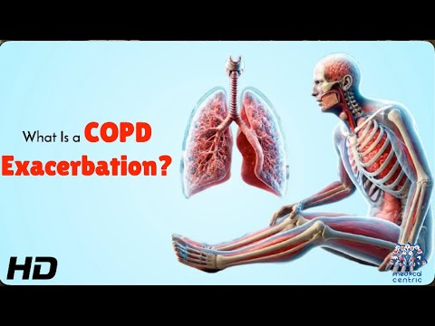 COPD Attack Explained – Signs, Causes & What to Do
