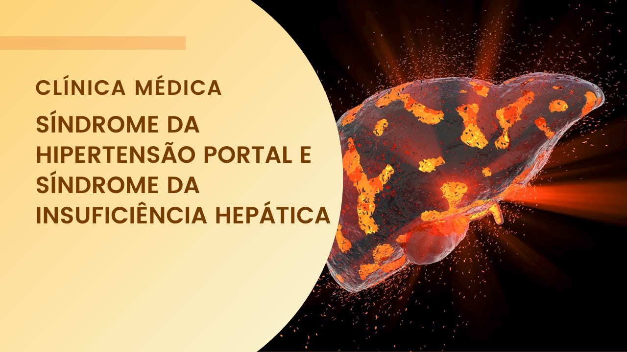 Síndrome da Hipertensão Portal e Síndrome da Insuficiência Hepática