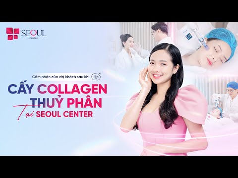 Cảm Nhận Của Chị Khách Sau Khi Cấy Collagen Thủy Phân