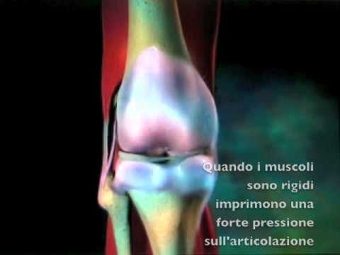 Scricchiolii al ginocchio e dolente, ma non gonfio Come sbarazzarsi del mal di schiena durante la gravidanza