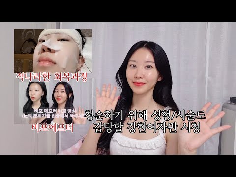 비디오 2
