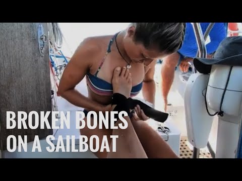 BROKEN BONES on a SAILBOAT in remote islands Los Roques - UNTIE THE LINES IV #72