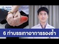 อาการ