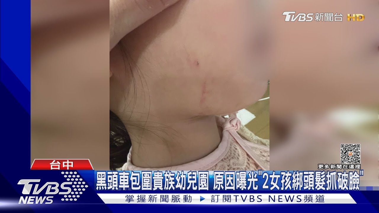 黑頭車包圍貴族幼兒園 原因曝光「2女孩綁頭髮抓破臉」