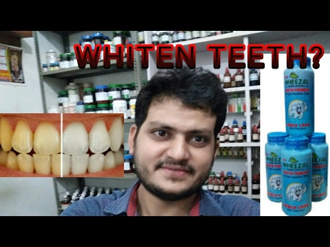 How to whiten teeth by homeopathic medicine?hekla lava tooth...