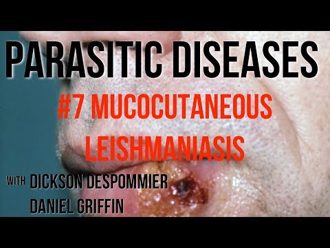 Parasites Without Borders, Parasitic Diseases Lectures #7: Mucocutaneous Leishmaniasis Leishmaniasis