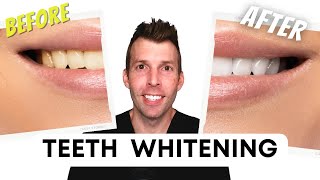 The best way to whiten teeth (what really works)