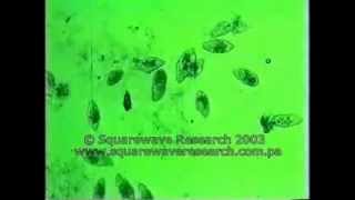 Rife Machine Killing Bacteria