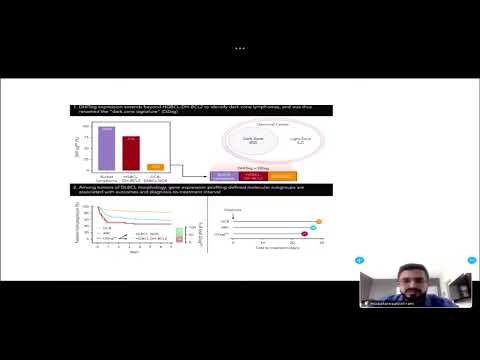 11 Updates on Burkitts lymphoma | Dr. Musa Alzahrani | 25 Oct 2024