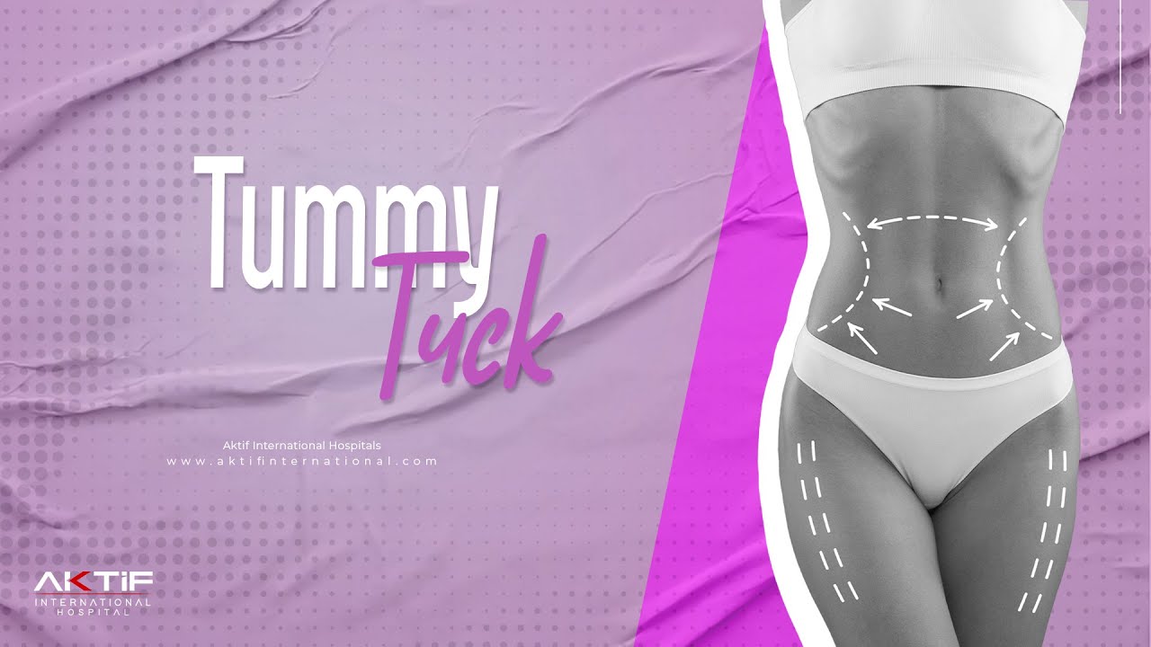 Tummy Tuck