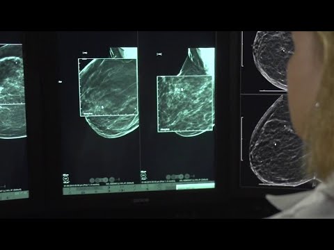 How COVID-19 complicated breast cancer