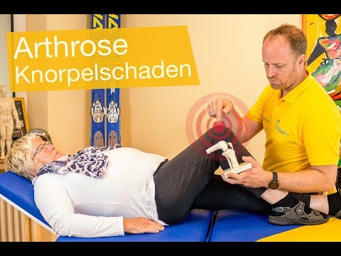 Die Arthrose Lüge ⚡️stimmt das❓ Kann man Arthrose heilen❓Infos vom Sportmediziner