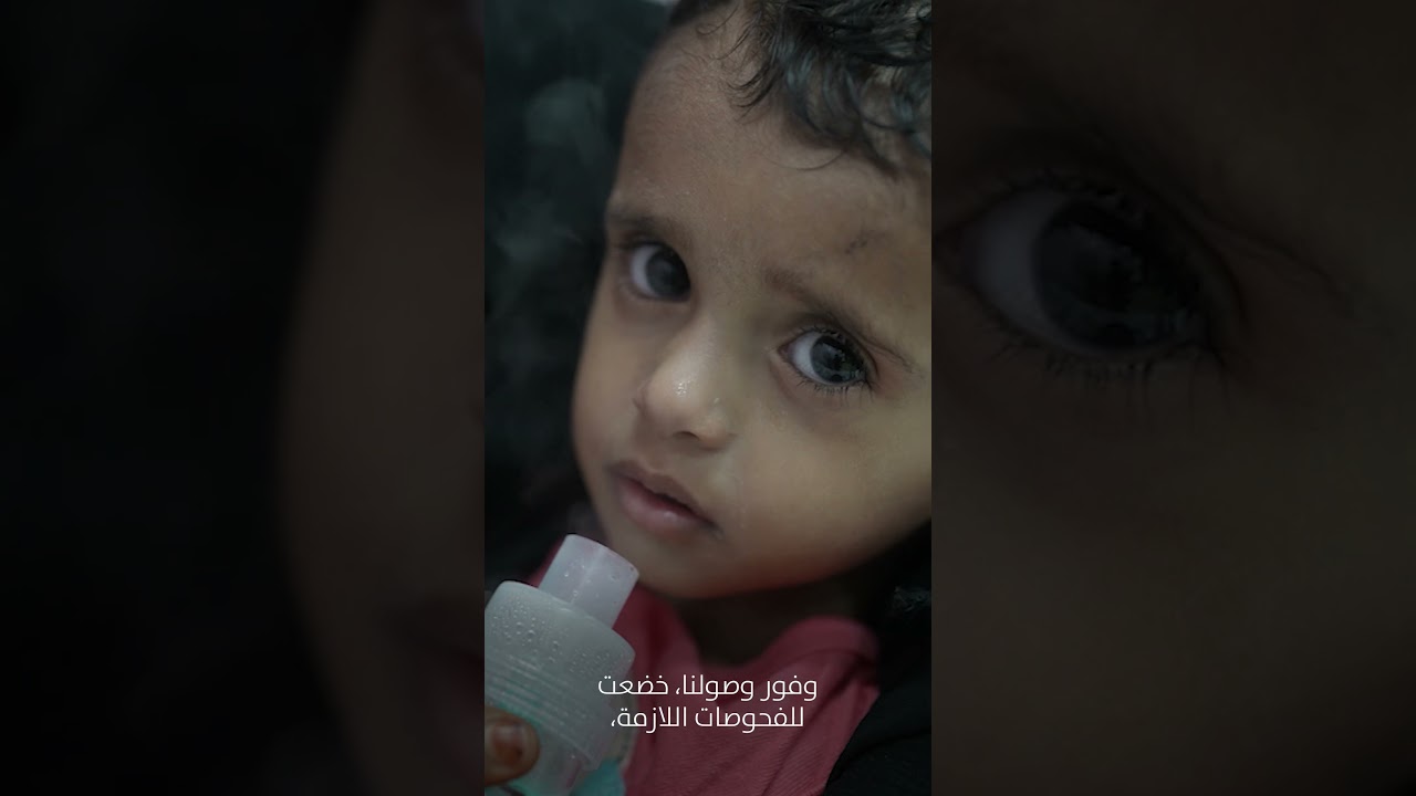 منظمة الصحة العالمية والاتحاد الأوروبي: إنقاذ حياة الأطفال في اليمن عبر الرعاية التغذوية