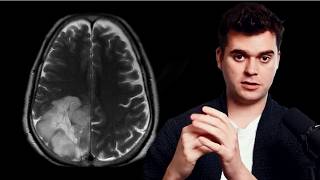 I have brain cancer.
