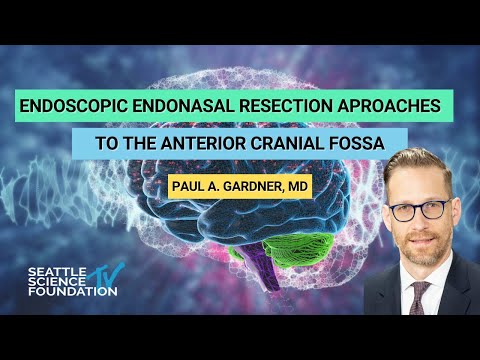 Endoscopic Endonasal Resection Aproaches to the Anterior Cranial Fossa   Paul A. Gardner, MD