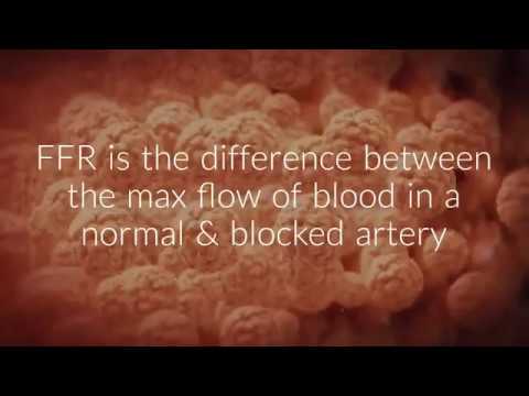 What is FFR?