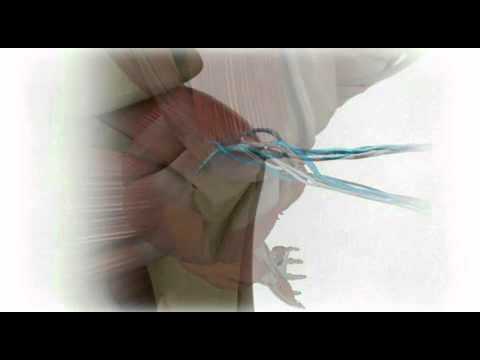 JuggerKnot Rotator Cuff Repair